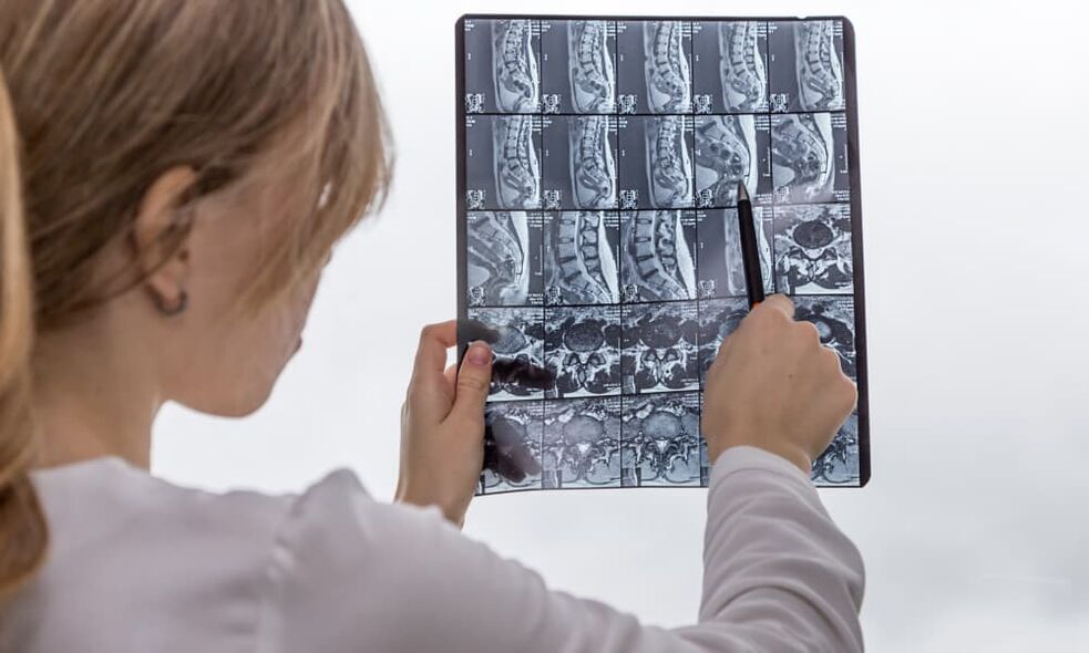 Magnetic resonance imaging will help doctors identify osteochondrosis and plan treatment