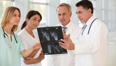 Arthritis and Arthritis Choice