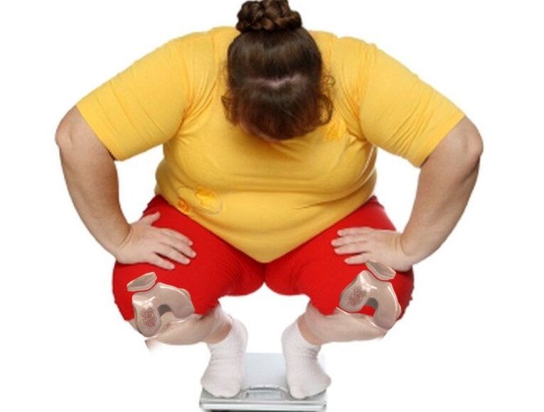 Among patients with joint disease, most are overweight or obese