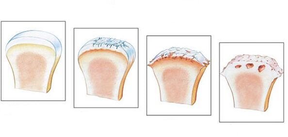 Healthy Joints and Level 3 Joint Development