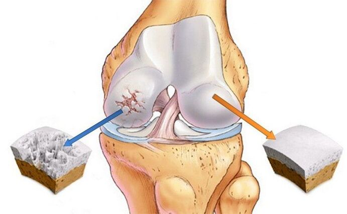 healthy joints and joints