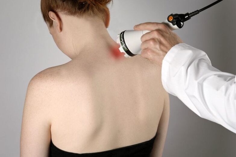 Laser treatment for cervical osteochondrosis in women